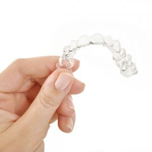 aparat ortodontyczny - ortodoncja