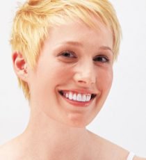 efekt po wybielaniu zębów - biały uśmiech